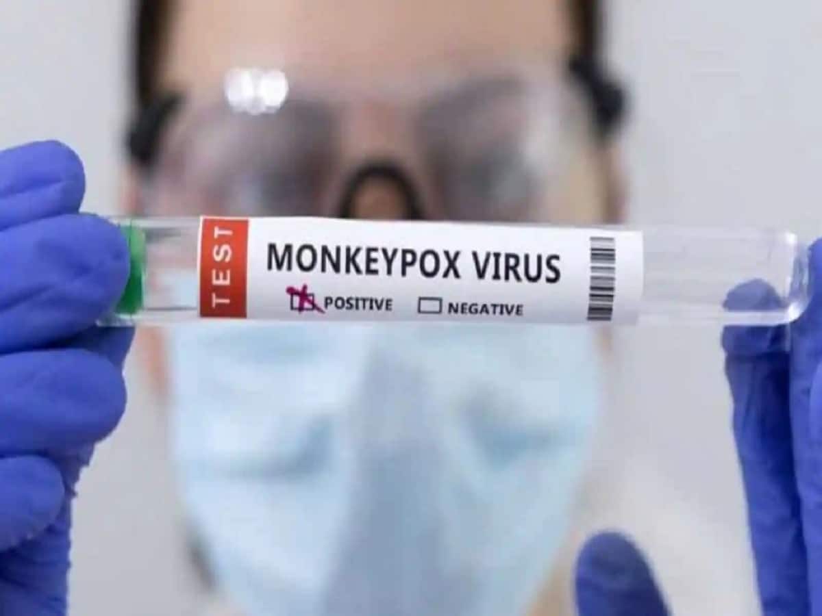 35-Yr-Old Woman Becomes First Monkeypox Patient In Vietnam, India Logs 1,968 New COVID-19 Cases